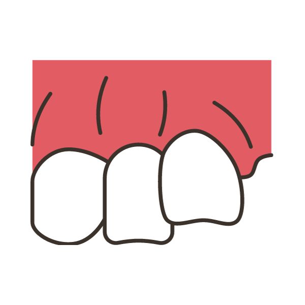 uneven teeth hakimi dental