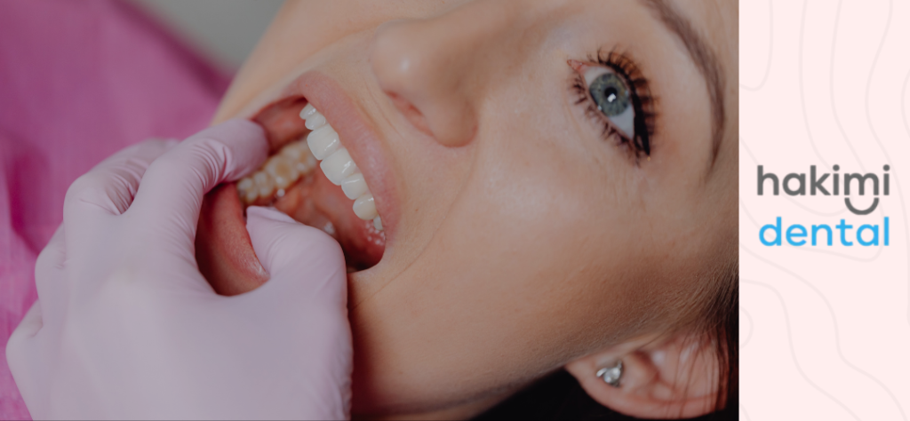 periocoronitis - patient during consultation